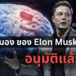 Brain Chip จาก Neuralink บริษัทของ Elon Musk ได้รับการอนุมัติจาก FDA แล้ว!