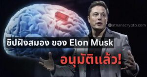 Brain Chip จาก Neuralink บริษัทของ Elon Musk ได้รับการอนุมัติจาก FDA แล้ว!